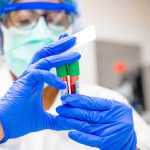 Novedosa terapia da resultados positivos en pacientes con anemia falciforme: Cleveland Clinic Children's