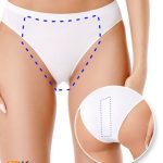 Tecnología YAG Candela facilita depilacion bikini brasileño en Kopay de Gele Giner